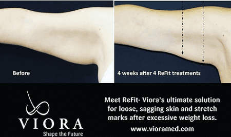 Viora Laser Tulsa Oklahoma