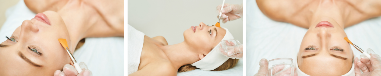 Chemical Peels Tulsa Oklahoma